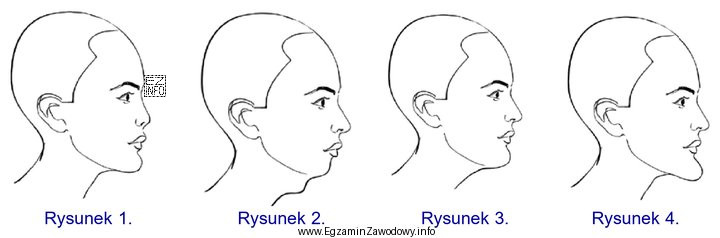 Na którym rysunku schematycznym przedstawiono wysuniętą brodę?