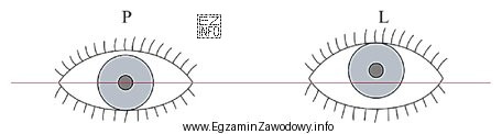 Nieprawidłowe ustawienie oczu w pozycji na wprost jak na 