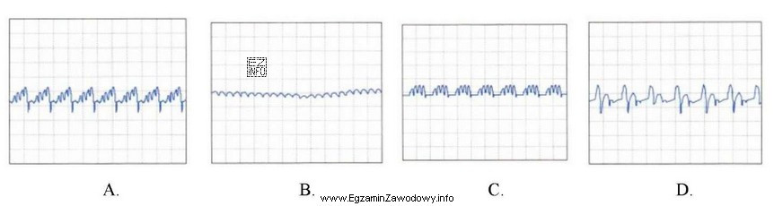 Który z oscylogramów przedstawionych na rysunkach, odczytany z 