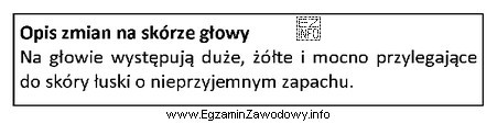 Opis dotyczy zmian na skórze głowy charakterystycznych dla