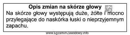 Przedstawiony opis dotyczy zmian na skórze głowy, charakterystycznych 