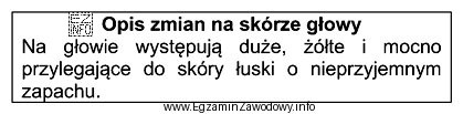 Przedstawiony opis dotyczy zmian na skórze głowy, charakterystycznych 