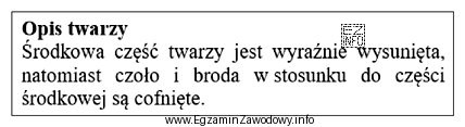 Zamieszczony opis dotyczy twarzy o kształcie profilu