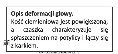 Której deformacji głowy dotyczy opis?