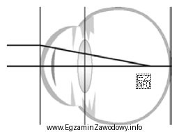 Schemat przedstawia oko