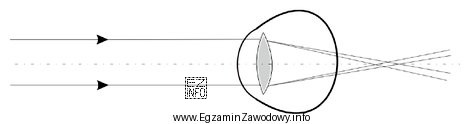Zamieszczony rysunek przedstawia astygmatyzm
