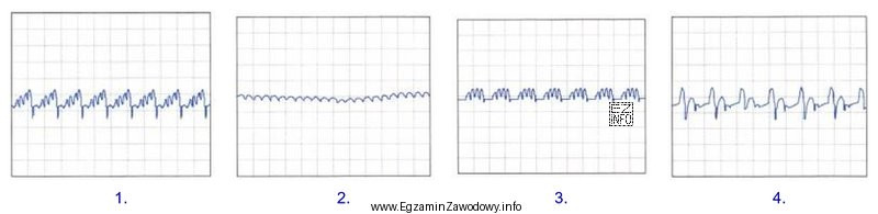 Który z oscylogramów przedstawionych na rysunkach, odczytany z 
