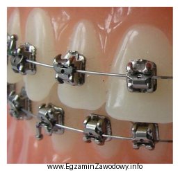 Które elementy umieszczone na powierzchni zębów są 