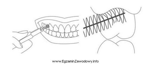 Instruktaż higieny jamy ustnej przedstawiony na rysunku obrazuje użycie 