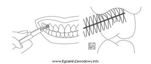 Instruktaż higieny jamy ustnej przedstawiony na rysunku obrazuje użycie 
