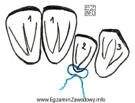 Który element druciany przedstawiony jest na ilustracji kolorem niebieskim?