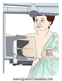 Na ilustracji przedstawiono pozycjonowanie pacjentki do badania mammograficznego w projekcji