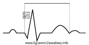 Na wykresie EKG zaznaczono