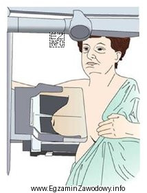 Na ilustracji przedstawiono pozycjonowanie pacjentki do badania mammograficznego w projekcji