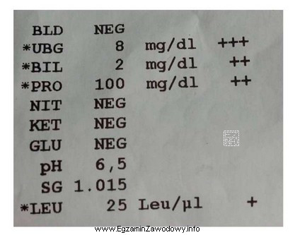 Na rysunku przedstawiono wydruk badania moczu. Który parametr ma 