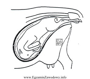 Rysunek przedstawia ułożenie płodu