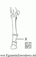 Na rysunku litera X zaznaczono kość