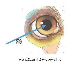 Na rysunku przedstawiającym oko psa strzałka wskazuje