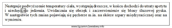 Przedstawiony opis wskazuje na