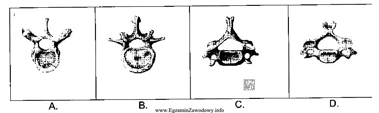 Na rysunkach przedstawiono wybrane kręgi kręgosłupa. Krę