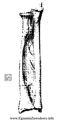 Na rysunku widoczne są kości