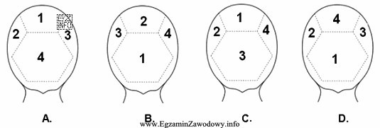 Na którym z rysunków został przedstawiony podział wł