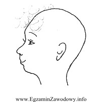 Profil zaprezentowany na zamieszczonym rysunku skoryguje fryzura