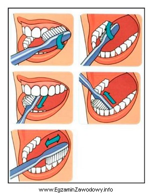Którą metodę szczotkowania zębów przedstawiają rysunki?