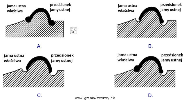 Prawidłowo wykonane obrzeże dolnej łyżki indywidualnej przedstawia 