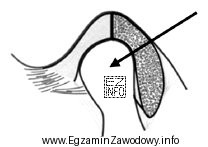 Który element stawu skroniowo-żuchwowego zaznaczono strzałką na 