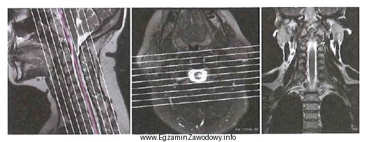 Obrazy MR kręgosłupa szyjnego przedstawiają etap planowania badania 