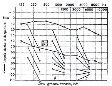 Audiogram przedstawia próbę