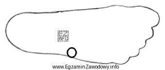 Która struktura anatomiczna została oznaczona na obrysie stopy?