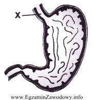Na rysunku budowy żołądka literą X oznaczono 